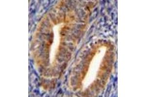 Immunohistochemistry (Paraffin-embedded Sections) (IHC (p)) image for anti-Dipeptidyl-Peptidase 3 (DPP3) (AA 590-620), (C-Term) antibody (ABIN951978)