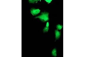 Anti-FBXO21 mouse monoclonal antibody (ABIN2455368) immunofluorescent staining of COS7 cells transiently transfected by pCMV6-ENTRY FBXO21 (RC223095). (FBXO21 antibody)