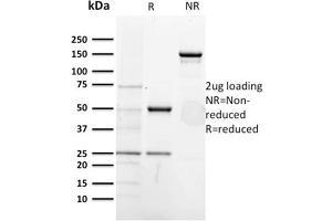 SDS-PAGE AnalysisPurified CD5-Monospecific Mouse Monoclonal Antibody (CD5/2418). (CD5 antibody  (AA 269-366))