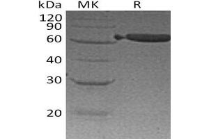 Western Blotting (WB) image for Epithelial Cell Adhesion Molecule (EPCAM) (Active) protein (Fc Tag) (ABIN7320835) (EpCAM Protein (Fc Tag))