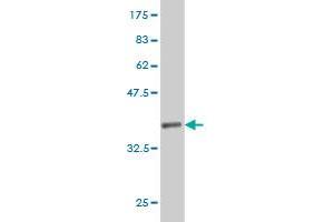 Western Blot detection against Immunogen (37. (PTGES2 antibody  (AA 270-377))