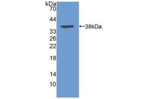 Detection of Recombinant VLDLR, Human using Polyclonal Antibody to Very Low Density Lipoprotein Receptor (VLDLR) (VLDLR antibody  (AA 418-722))