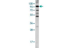 Western blot analysis of LGR5 polyclonal antibody  in K-562 cell line lysates (35 ug/lane).