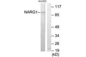 Western blot analysis of extracts from HuvEc cells, using NARG1 Antibody. (NAA15 antibody  (AA 221-270))