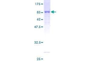 DAK Protein (AA 1-575) (GST tag)