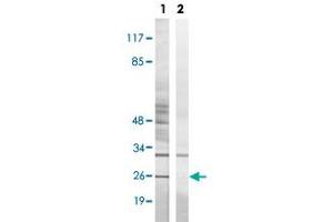 Western blot analysis of Lane 1: Untreated K562 cell lysates, Lane 2: Synthesized peptide treated K562 cell lysates reacted with BIK (phospho T33) polyclonal antibody  at 1:500-1:3000 dilution. (BIK antibody  (pThr33))