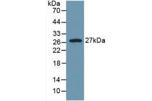 Detection of Recombinant IL6, Rat using Monoclonal Antibody to Interleukin 6 (IL6) (IL-6 antibody  (AA 25-211))