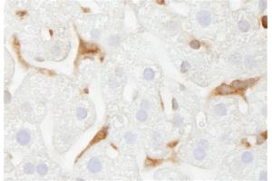 Immunohistochemistry (IHC) image for anti-Glucose-6-Phosphate Dehydrogenase (G6PD) (AA 50-100) antibody (ABIN7448574)