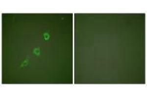 Immunofluorescence analysis of NIH/3T3 cells, using HSP10 antibody. (HSPE1 antibody)