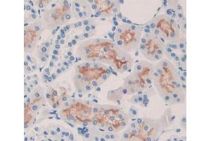 Used in DAB staining on fromalin fixed paraffin- embedded kidney tissue (ABCC6 antibody  (AA 1260-1502))