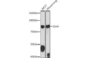 Western blot analysis of extracts of various cell lines, using Zyxin Rabbit mAb (ABIN1682627, ABIN3015962, ABIN3015963 and ABIN7101467) at 1:1000 dilution. (ZYX antibody)