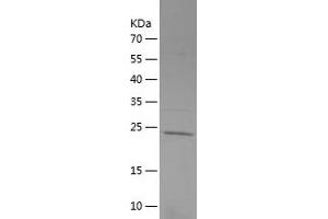 Western Blotting (WB) image for Unc-51 Like Kinase 1 (ULK1) (AA 400-599) protein (His tag) (ABIN7283550) (ULK1 Protein (AA 400-599) (His tag))