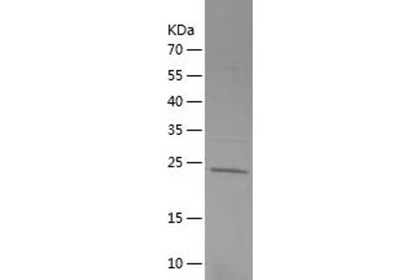 ULK1 Protein (AA 400-599) (His tag)