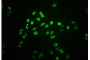 Immunofluorescence staining of HepG2 cells(treated with 100 mM Calyculin A for 30 min) with ABIN7127753 at 1:66,counter-stained with DAPI. (Recombinant STAT1 antibody  (pSer727))
