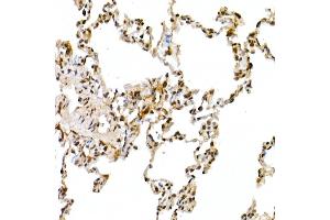Immunohistochemistry of paraffin-embedded rat lung using Cullin 1 Rabbit pAb (ABIN3015863, ABIN3015864, ABIN3015865 and ABIN6219345) at dilution of 1:50 (40x lens). (Cullin 1 antibody  (AA 500-776))