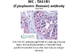 Image no. 1 for anti-Taste Receptor, Type 1, Member 1 (TAS1R1) (3rd Cytoplasmic Domain) antibody (ABIN1739914) (TAS1R1 antibody  (3rd Cytoplasmic Domain))