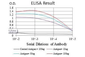 Black line: Control Antigen (100 ng), Purple line: Antigen(10 ng), Blue line: Antigen (50 ng), Red line: Antigen (100 ng), (SOX9 antibody)