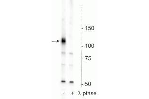 Western blot of rat hippocampal membrane lysate showing specific immunolabeling of the ~120 kDa Polo-Like Kinase Kinase phosphorylated at Ser482,486,490 in the first lane (-). (PLK1 antibody  (pSer482, pSer486, pSer490))