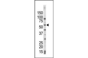 Image no. 1 for anti-Mitogen-Activated Protein Kinase Kinase Kinase 8 (MAP3K8) (C-Term) antibody (ABIN360360) (MAP3K8 antibody  (C-Term))