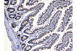 IHC analysis of Caspase8 using anti-Caspase8 antibody . (Caspase 8 antibody  (N-Term))