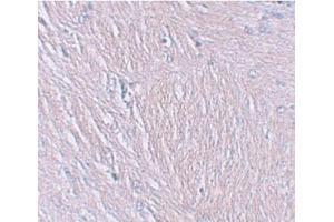 Immunohistochemistry of SYNPO in human brain tissue with SYNPO Antibody  at 2. (SYNPO antibody  (C-Term))