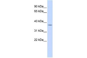 WB Suggested Anti-PAntibody Titration:  0. (PARP16 antibody  (Middle Region))