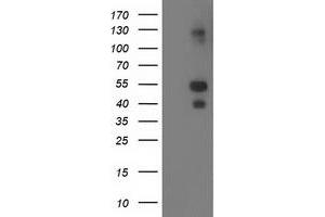 HEK293T cells were transfected with the pCMV6-ENTRY control (Left lane) or pCMV6-ENTRY LMCD1 (Right lane) cDNA for 48 hrs and lysed. (LMCD1 antibody)