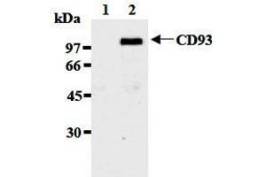 Western Blotting (WB) image for anti-CD93 (CD93) antibody (ABIN1449221) (CD93 antibody)