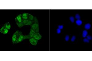 Immunofluorescence analysis of HeLa cells using CREB1 antibody (ABIN5996963).