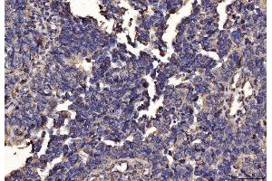 IHC analysis of PDIA6 using anti-PDIA6 antibody (ABIN7600554). (PDIA6 antibody  (AA 20-440))