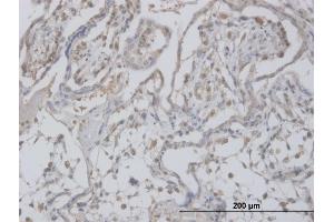 Immunoperoxidase of monoclonal antibody to CLIC1 on formalin-fixed paraffin-embedded human placenta. (CLIC1 antibody  (AA 1-241))