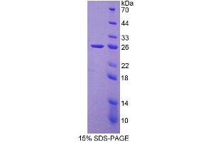 Image no. 1 for Chromatin Assembly Factor 1, Subunit B (p60) (CHAF1B) (AA 1-199) protein (His tag) (ABIN4990808)