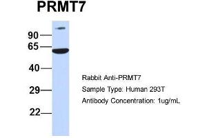Host:  Rabbit  Target Name:  PRMT7  Sample Type:  Human 293T  Antibody Dilution:  1. (PRMT7 antibody  (N-Term))