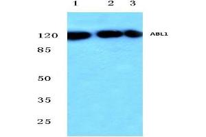 Western blot analysis of c-Abl antibody at 1/500 dilution in HepG2 whole cell lysate (Lane 1), Mouse (Lane 2) and Rat (Lane 3) liver tissue lysates.