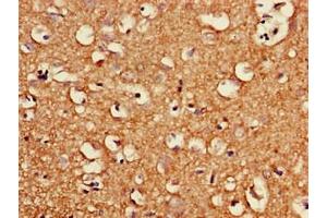 Immunohistochemistry of paraffin-embedded human brain tissue using ABIN7163987 at dilution of 1:100