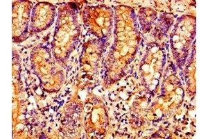 Immunohistochemistry of paraffin-embedded human small intestine tissue using ABIN7162387 at dilution of 1:100 (OXER1 antibody  (AA 1-97))