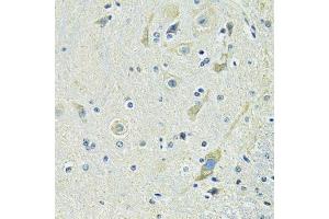 Immunohistochemistry of paraffin-embedded mouse spinal cord using SLC1A4 antibody. (SLC1A4 antibody  (AA 140-220))