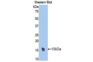 Western Blotting (WB) image for anti-Trefoil Factor 2 (TFF2) (AA 27-129) antibody (ABIN1173513) (Trefoil Factor 2 antibody  (AA 27-129))