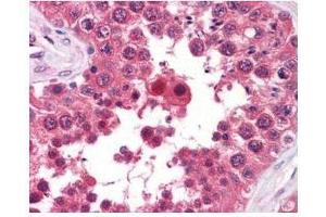 anti-AHA1 monoclonal antibody was used at a 5-10 µg/mL to detect AHA1 in the seminiferous tubule of human testis (40X) showing moderate staining. (AHSA1 antibody)