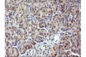 Image no. 1 for anti-Phosphoinositide-3-Kinase, Regulatory Subunit 5 (PIK3R5) antibody (ABIN1500214) (PIK3R5 antibody)