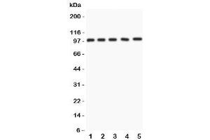 Western blot testing of NUP98 antibody and Lane 1:  rat liver (NUP98 antibody  (AA 549-880))