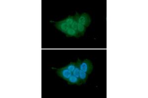 ICC/IF analysis of MCM7 in MCF7 cells. (MCM7 antibody  (AA 1-414))
