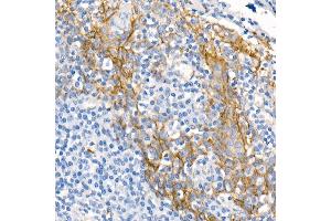 Immunohistochemistry of paraffin-embedded Human tonsil using δ-Catenin/p120 Catenin antibody (ABIN7266144) at dilution of 1:500 (40x lens). (CTNND1 antibody)