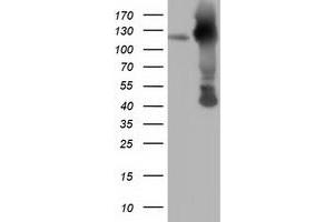 HEK293T cells were transfected with the pCMV6-ENTRY control (Left lane) or pCMV6-ENTRY MICAL1 (Right lane) cDNA for 48 hrs and lysed. (MICAL1 antibody)