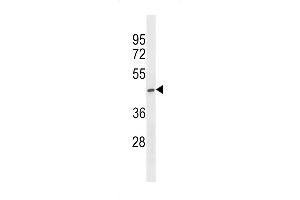 Western blot analysis in ZR-75-1 cell line lysates (35ug/lane). (ST6GALNAC5 antibody  (C-Term))