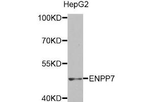 Western blot analysis of extracts of HepG2 cell line, using ENPP7 antibody. (ENPP7 antibody)
