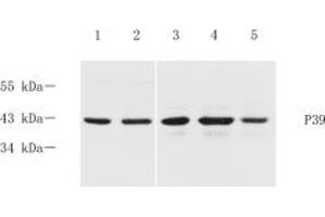Western blot analysis of p39 (ABIN7074968) at dilution of 1: 600,Lane 1: Mouse brain tissue lysate,Lane 2: Mouse cerebral cortex tissue lysate,Lane 3: Rat brain tissue lysate,Lane 4: Rat cerebral cortex tissue lysate,Lane 5: Rat hippocampus tissue lysate (p39 antibody)