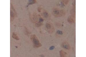 Figure. (NG2 antibody  (AA 1135-1444))