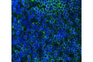 IF analysis of Cd79a using anti-Cd79a antibody (ABIN7601110). (CD79a antibody  (AA 29-220))