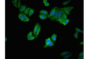 Immunofluorescent analysis of HepG2 cells using ABIN7151655 at dilution of 1:100 and Alexa Fluor 488-congugated AffiniPure Goat Anti-Rabbit IgG(H+L) (ERAP1 antibody  (AA 642-941))